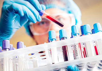 Estudios de Bioequivalencia y Biodisponibilidad